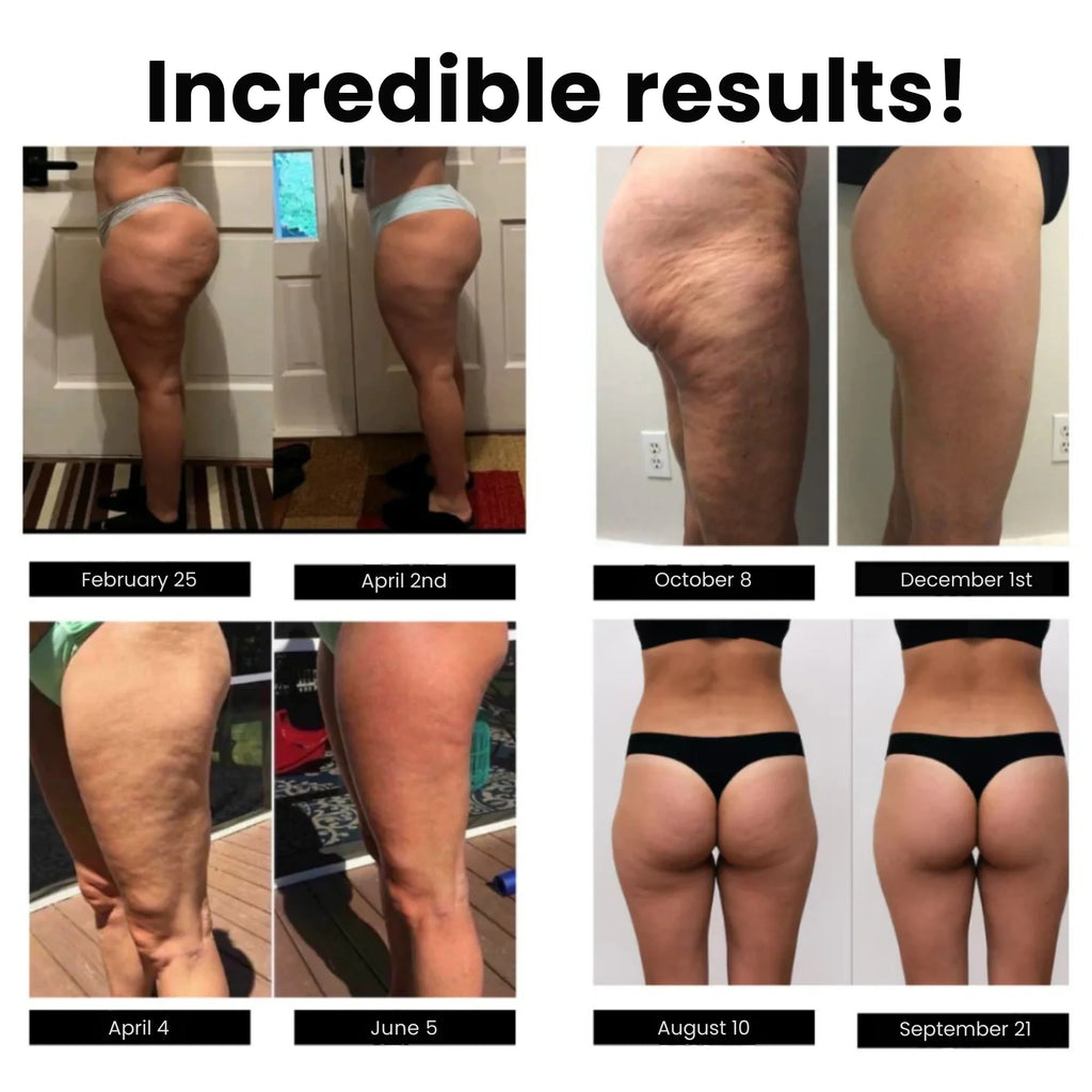 Legging Anti-Cellulite — photo 4